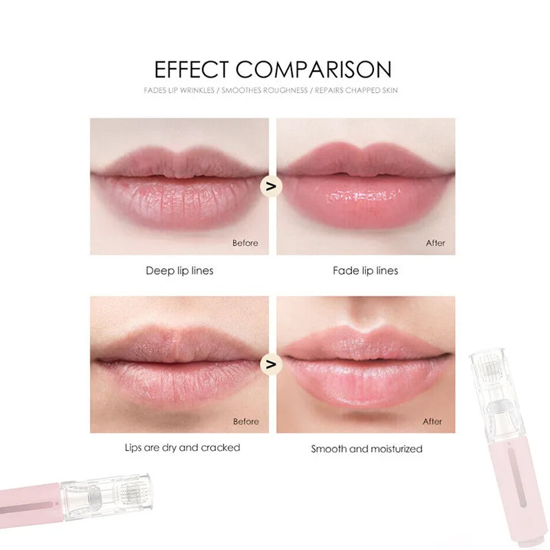 Titanium Lip Micro-Infusion Roller (0.20 / 0.25 / 0.30 mm) — Refillable Serum Tank